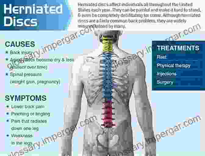 A Chart Displaying Different Treatment Plans For Various Spinal Conditions, Including Herniated Discs, Spinal Stenosis, And Chronic Back Pain Freedom To Move: Movement Therapy For Spinal Pain And Injuries