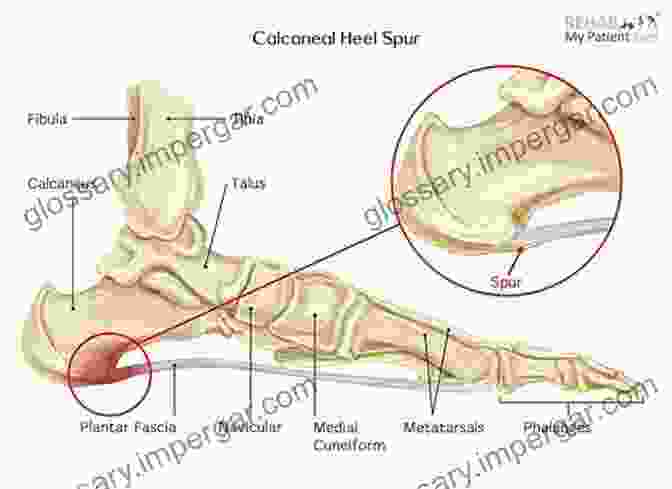 A Detailed Illustration Of The Human Calcaneum, Showcasing Its Sturdy Structure, The Insertion Of The Achilles Tendon, And The Cushioning Heel Pad, Emphasizing Its Vital Role In Weight Bearing And Shock Absorption. Adventures In Human Being: A Grand Tour From The Cranium To The Calcaneum