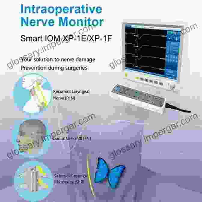 Diagram Of Intraoperative Monitoring System A Concise Guide To Intraoperative Monitoring