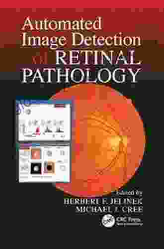 Automated Image Detection Of Retinal Pathology