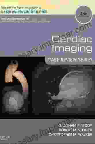 Cardiac Imaging: Case Review E